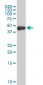 FOXA1 Antibody (monoclonal) (M05)